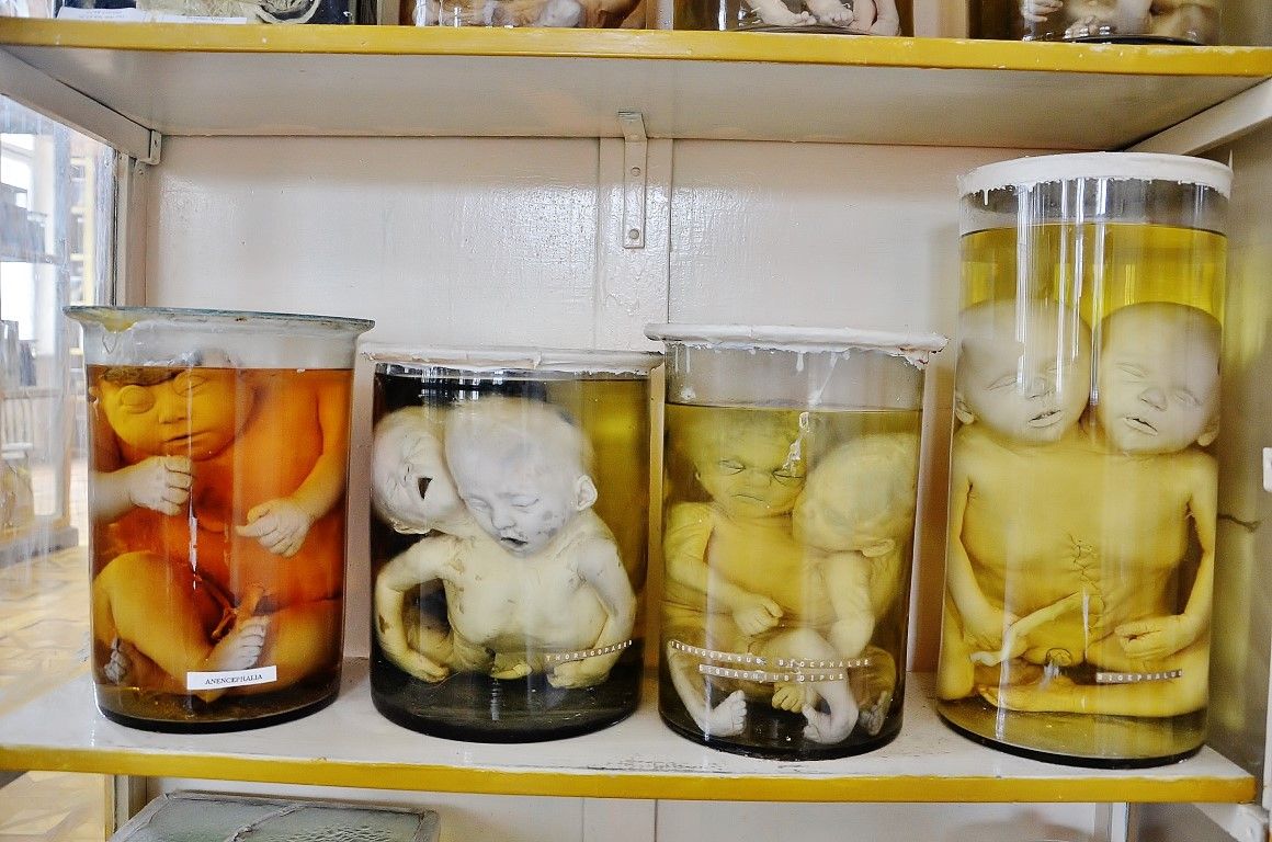 Думаете, вы сами не окажетесь на этом столике? 