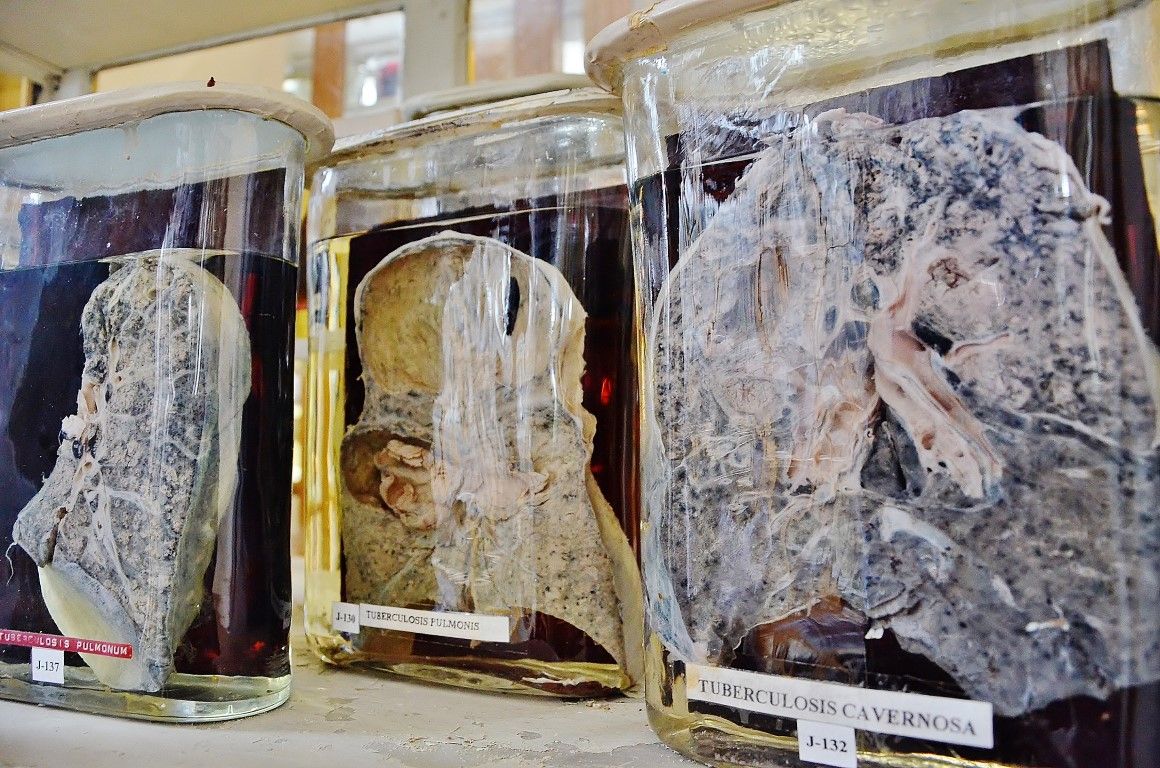 Думаете, вы сами не окажетесь на этом столике? 