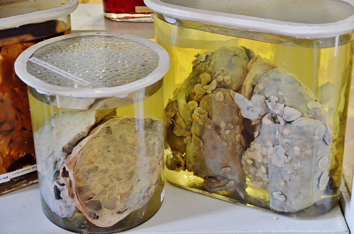 Думаете, вы сами не окажетесь на этом столике? 