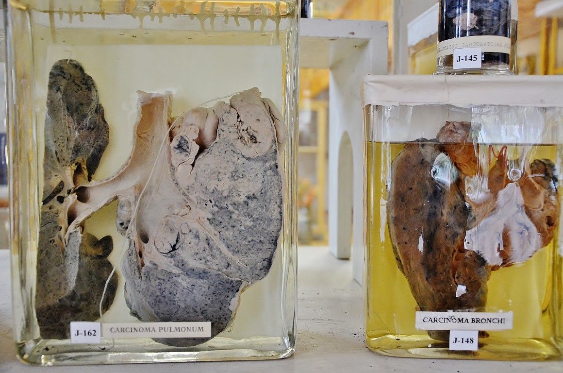 Думаете, вы сами не окажетесь на этом столике? 