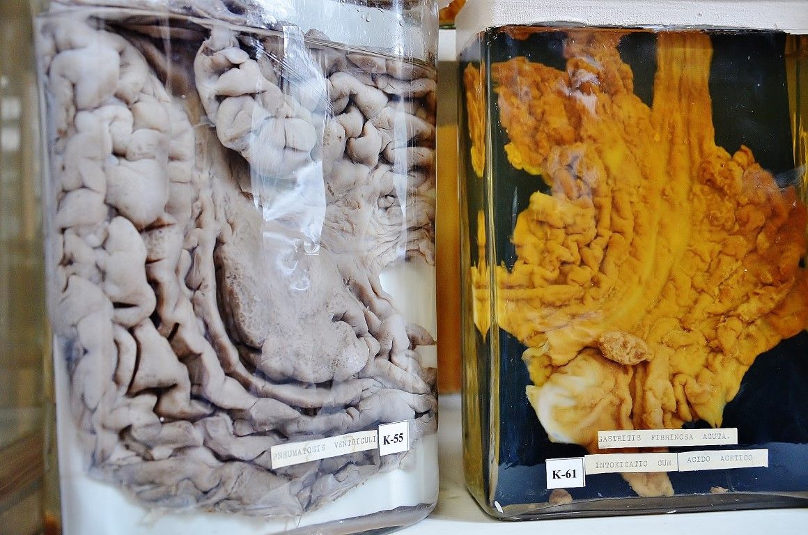 Думаете, вы сами не окажетесь на этом столике? 