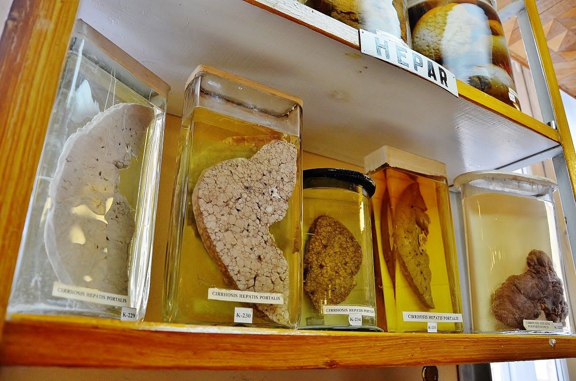 Думаете, вы сами не окажетесь на этом столике? 