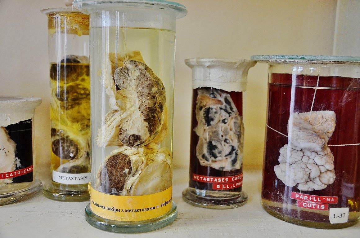 Думаете, вы сами не окажетесь на этом столике? 