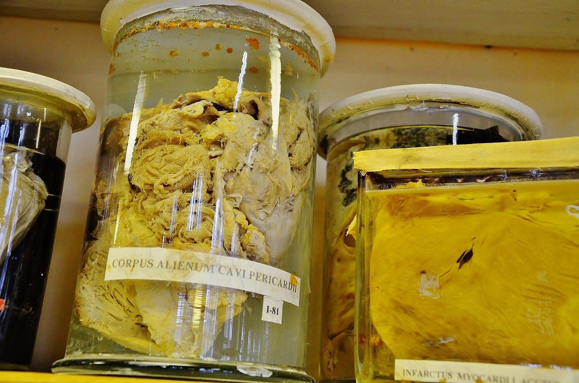 Думаете, вы сами не окажетесь на этом столике? 