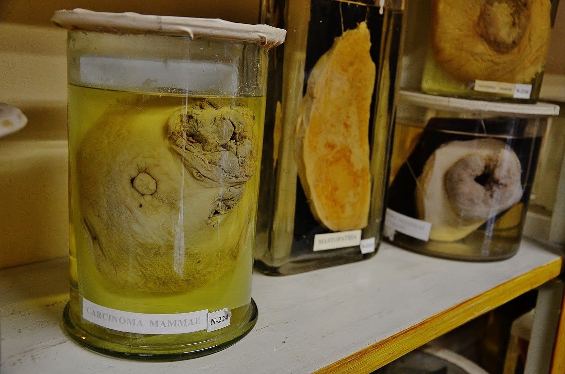 Думаете, вы сами не окажетесь на этом столике? 