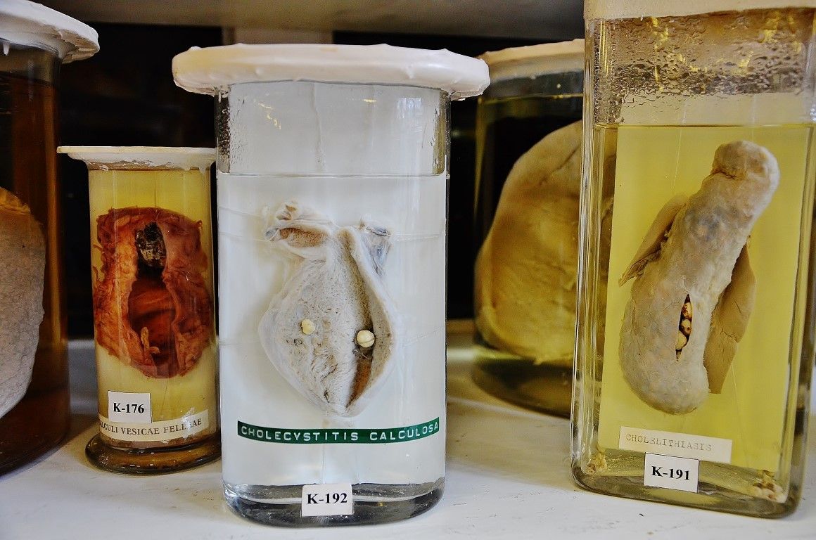 Думаете, вы сами не окажетесь на этом столике? 